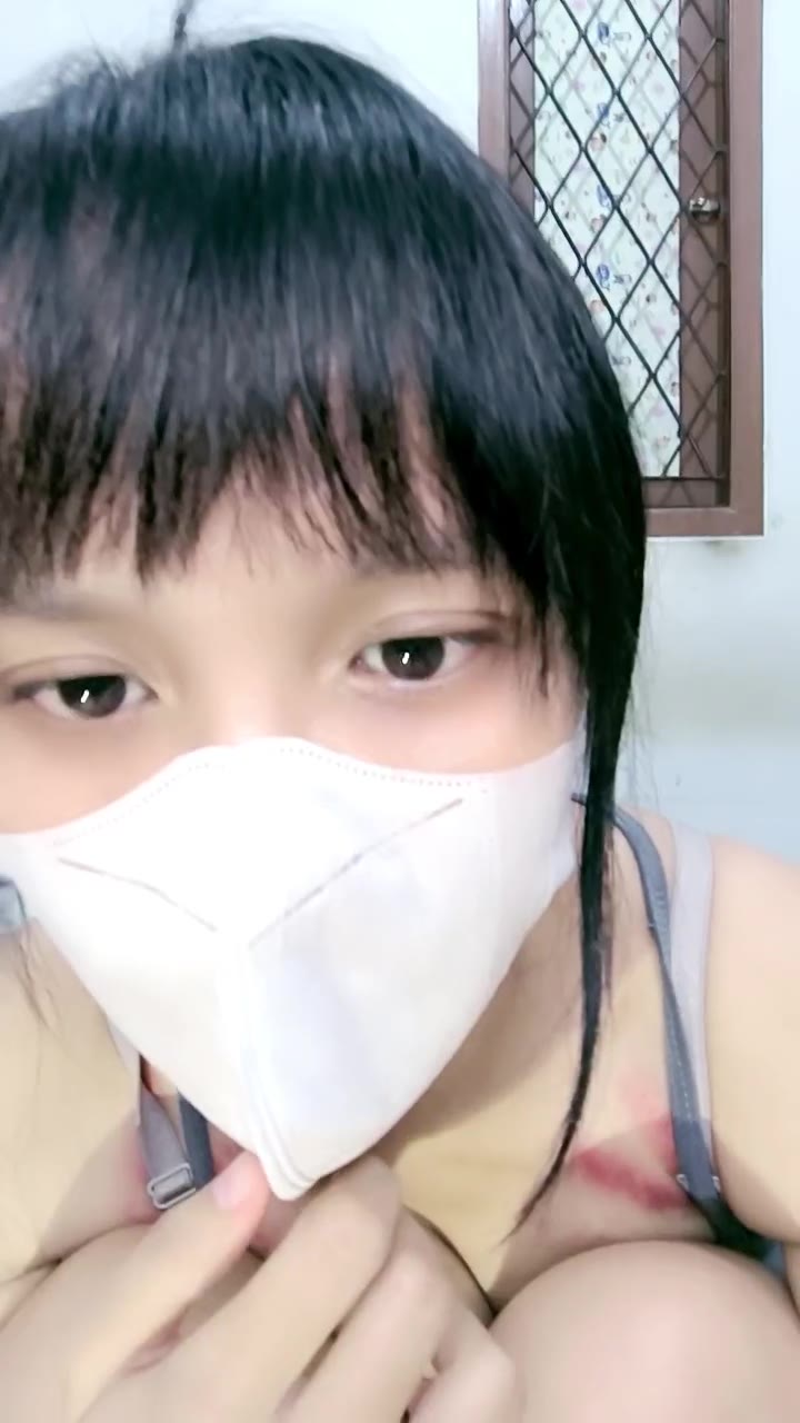 Meki Geter Andini Buka Masker Abis Kena Cupang? HOT51